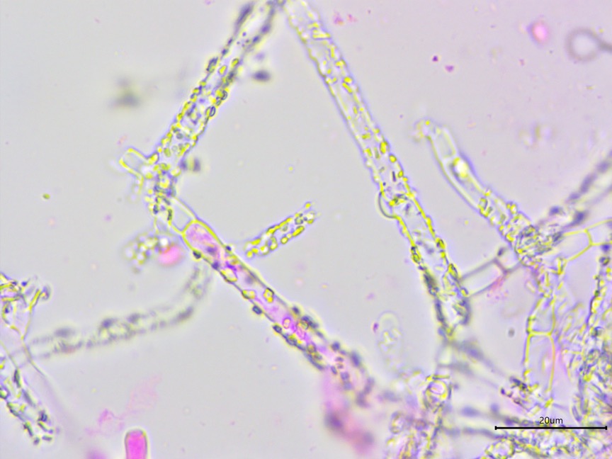 Athelia salicum sidebar image 3 - hyphae of Athelia salicum