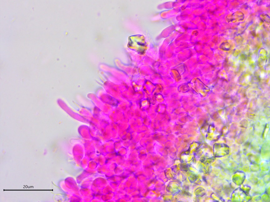 Athelia salicum sidebar image 7 - leptocystidia of Athelia salicum