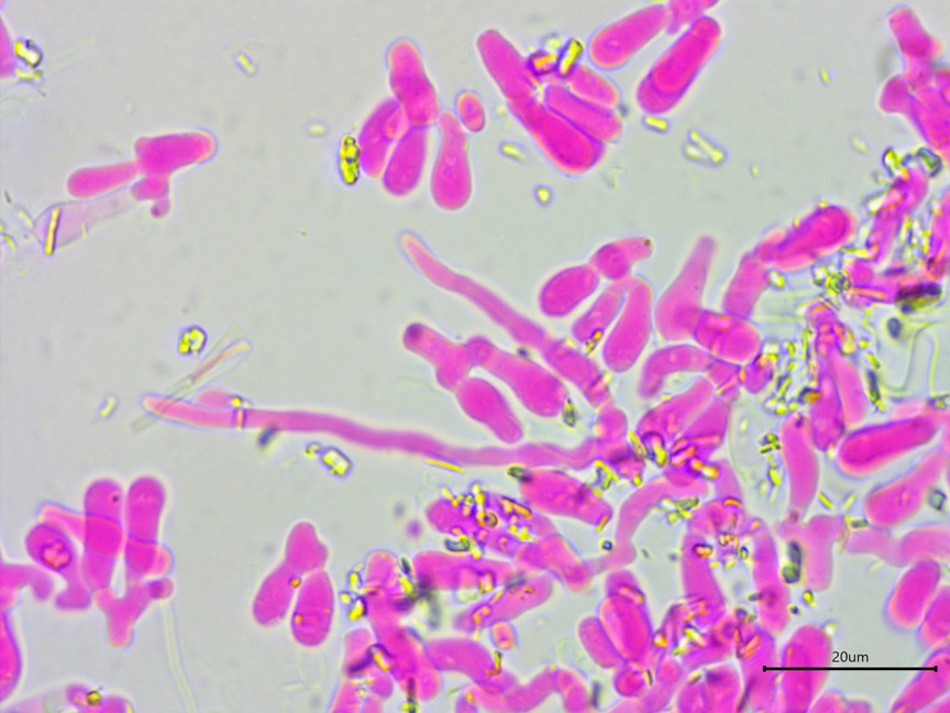 Athelia salicum sidebar image 8 - leptocystidia of Athelia salicum