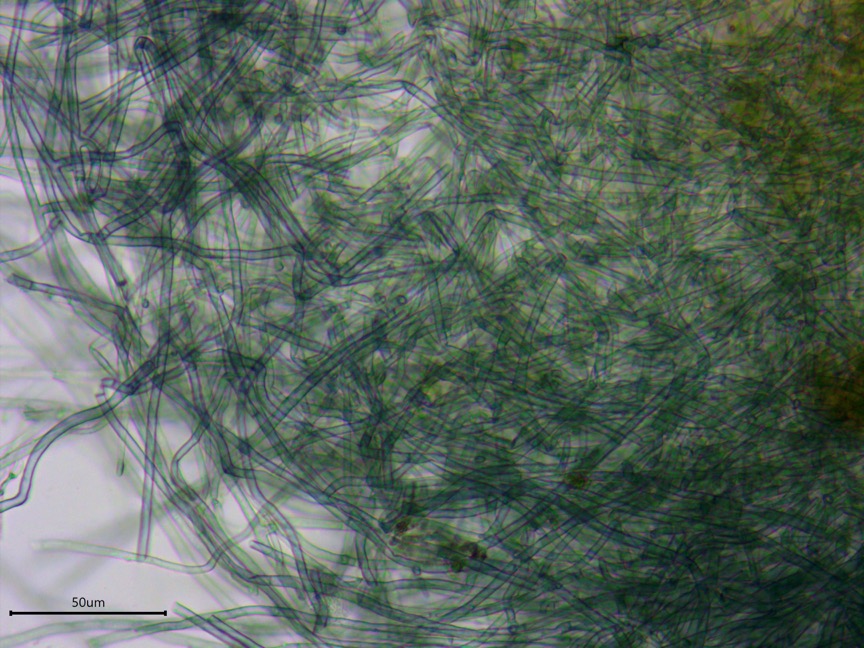 Byssocorticium atrovirens sidebar image 2 - blue-green hyphae of byssocorticium atrovirens