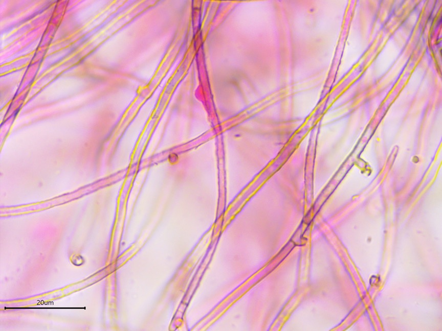 Byssocorticium atrovirens sidebar image 3 - rugose hyphae of Byssocorticium atrovirens