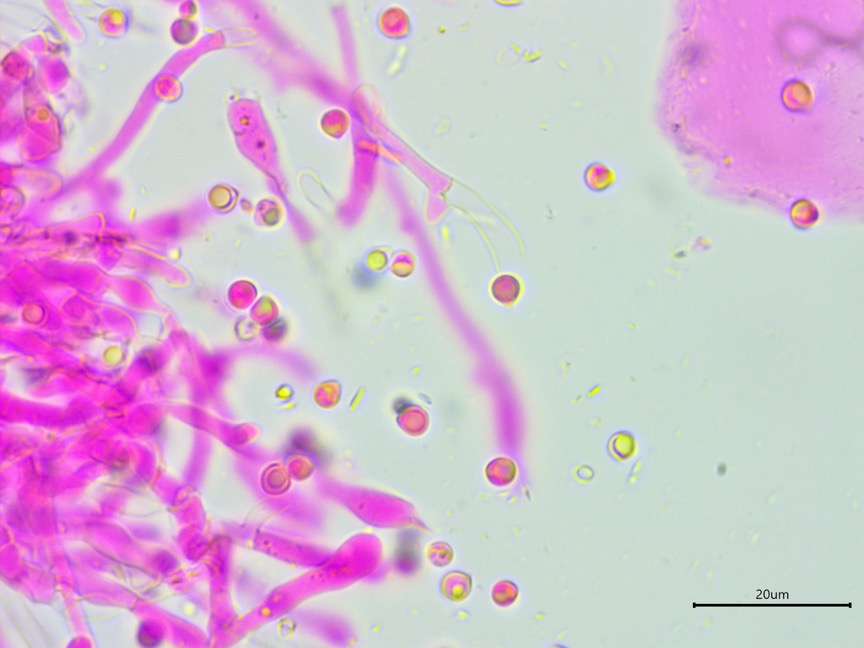 Byssocorticium atrovirens sidebar image 4 - spores of Byssocorticium atrovirens