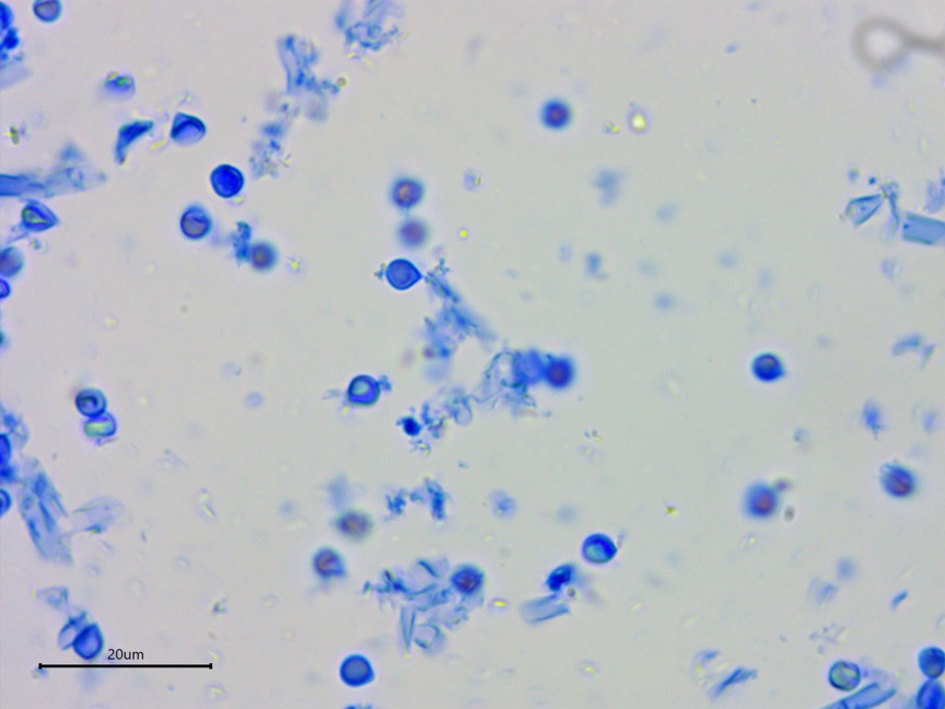 Byssocorticium atrovirens sidebar image 5 - cyanophilic spores of Byssocorticium atrovirens