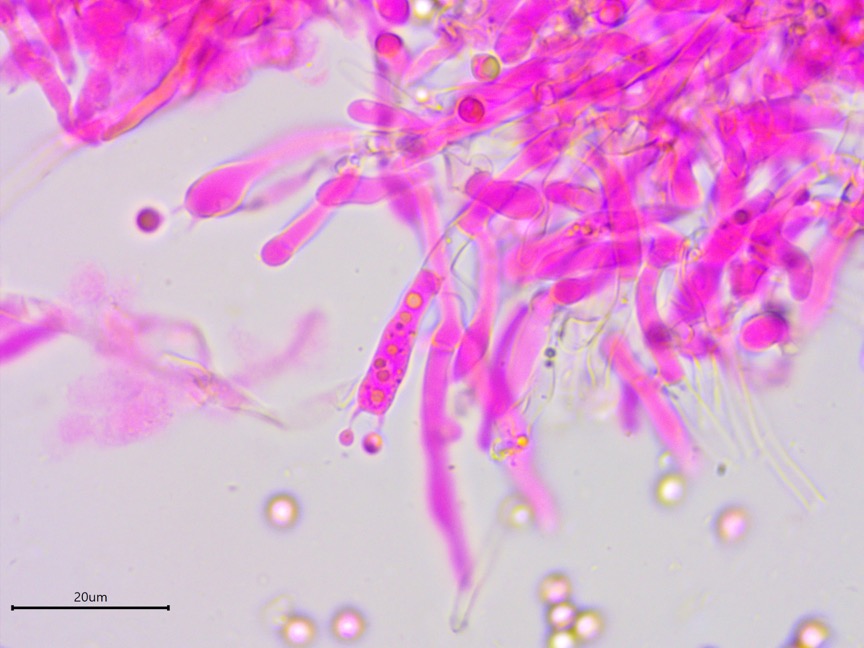 Byssocorticium atrovirens sidebar image 6 - basidia of Byssocorticium atrovirens