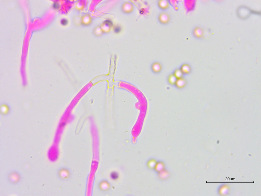 Byssocorticium atrovirens sidebar image 7 - clamp connections of Byssocorticium atrovirens