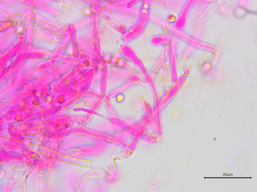 Byssocorticium atrovirens sidebar image 8 - hyphidia of Byssocorticium atrovirens