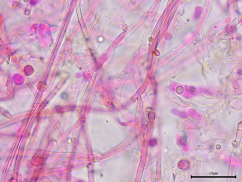 Byssocorticium pulchrum sidebar image 6