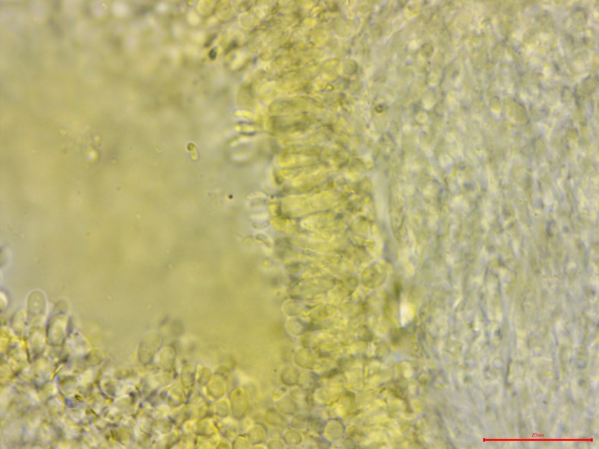 Ceriporia spissa sidebar image 6 - Ceriporia spissa basidia and spores