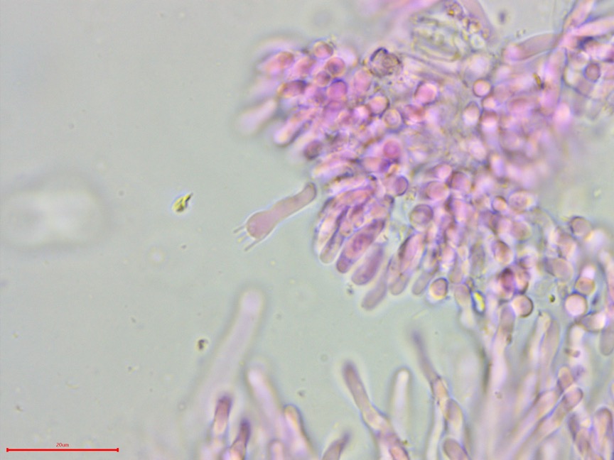 Ceriporia spissa sidebar image 7 - Ceriporia spissa basidium