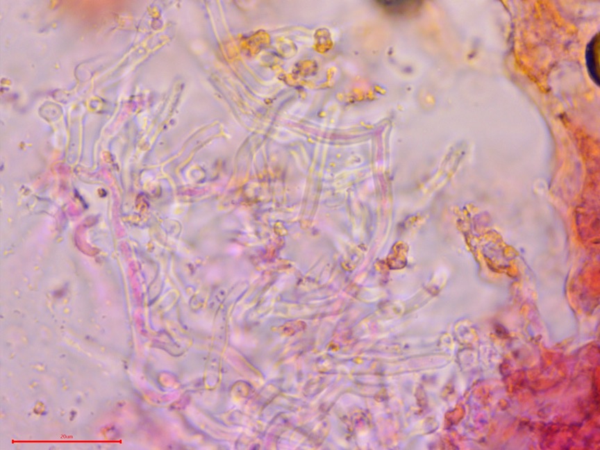 Ceriporia spissa sidebar image 8 - Ceriporia spissa subicular hyphae