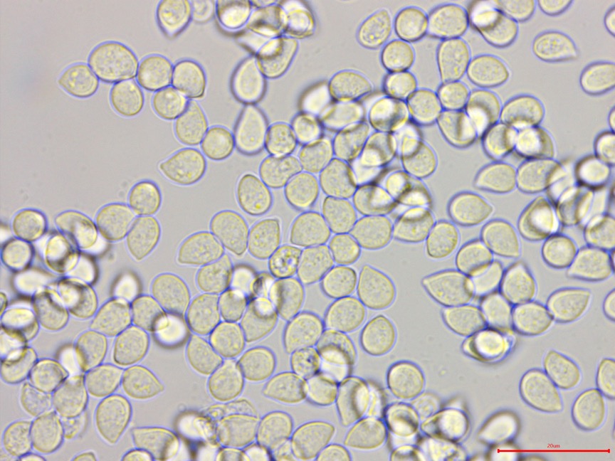 Cylindrobasidium evolvens sidebar image 4 - spores of Cylindrobasidium evolvens