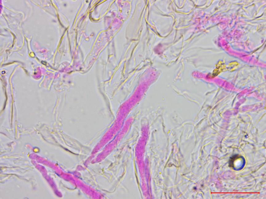 Cylindrobasidium evolvens sidebar image 5 - basidia of Cylindrobasidium evolvens