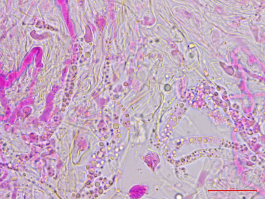 Cylindrobasidium evolvens sidebar image 6 - hyphae of Cylindrobasidium evolvens