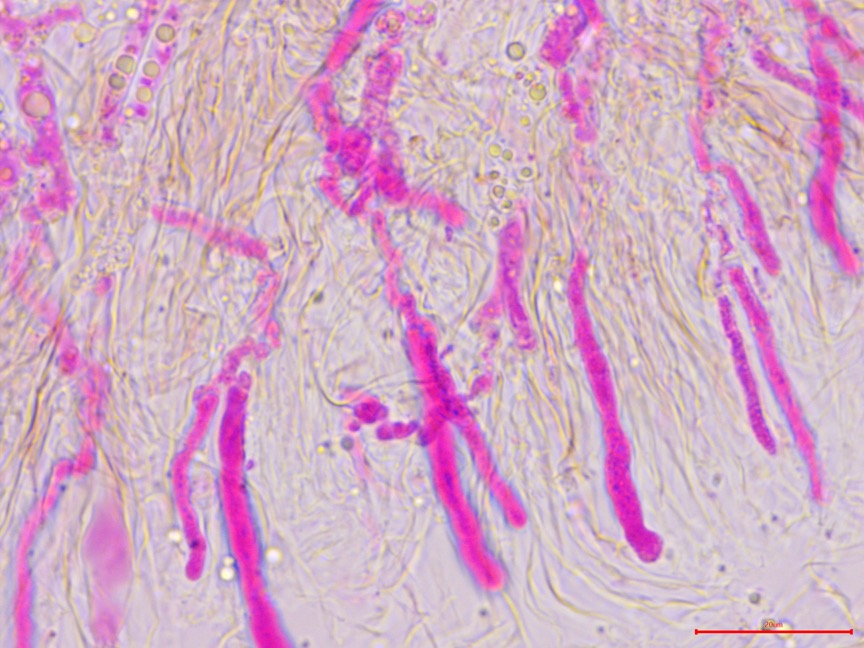 Cylindrobasidium evolvens sidebar image 7 - hymenium of Cylindrobasidium evolvens