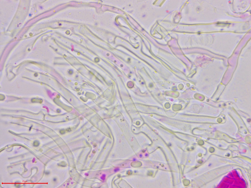 Cylindrobasidium evolvens sidebar image 8 - clamp connections of Cylindrobasidium evolvens