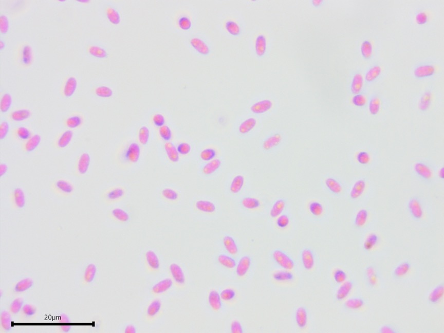 Mycoacia uda sidebar image 5 - basidiospores of Mycoacia uda