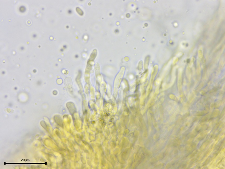 Mycoacia uda sidebar image 7 - clamp connections of Mycoacia uda