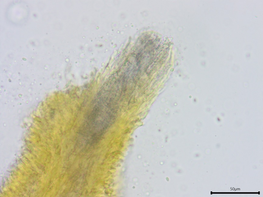 Mycoacia uda sidebar image 8 - aculei of Mycoacia uda
