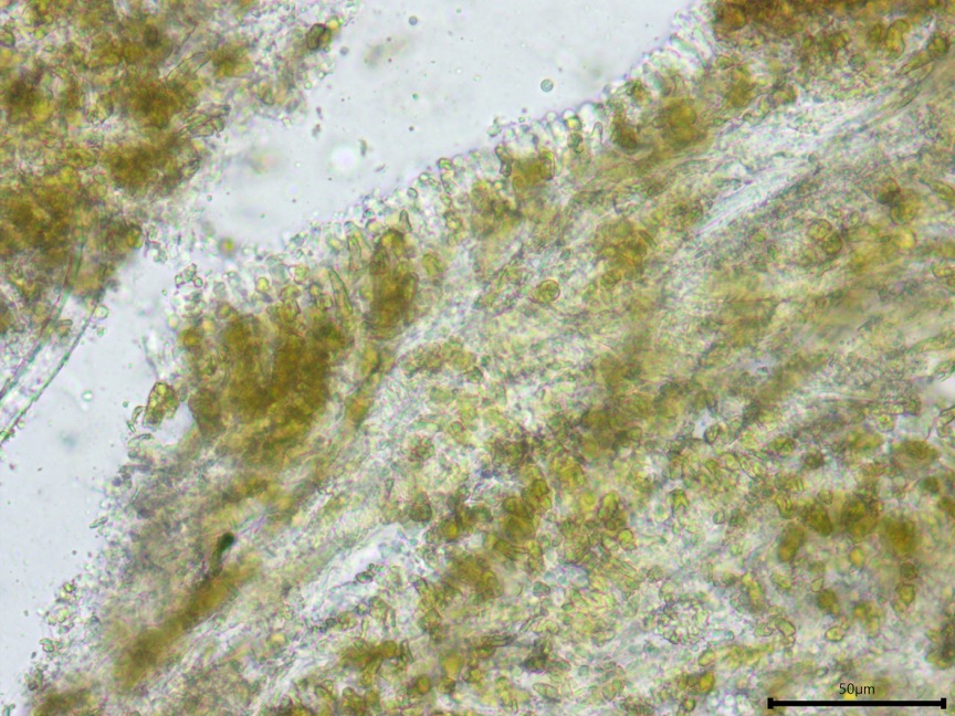 Mycoacia uda sidebar image 10 - cystidioles of Mycoacia uda