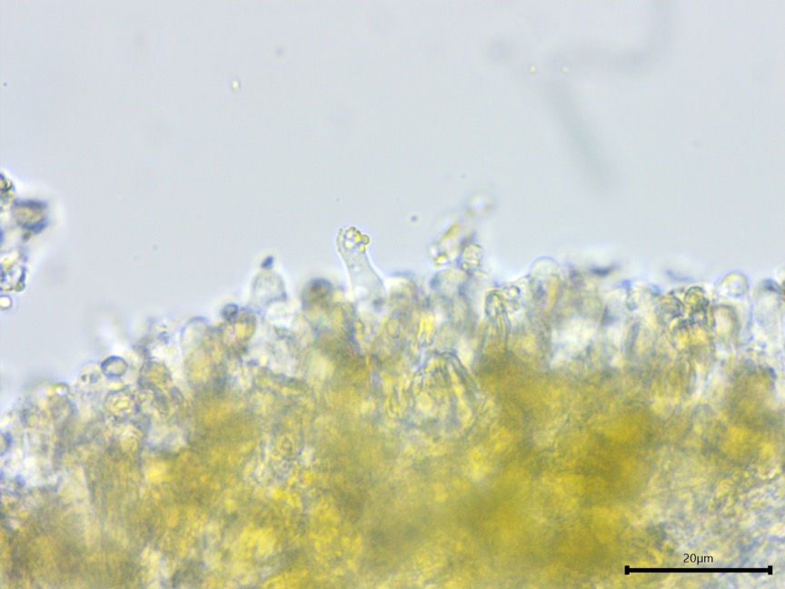 Mycoacia uda sidebar image 11 - cystidioles of Mycoacia uda