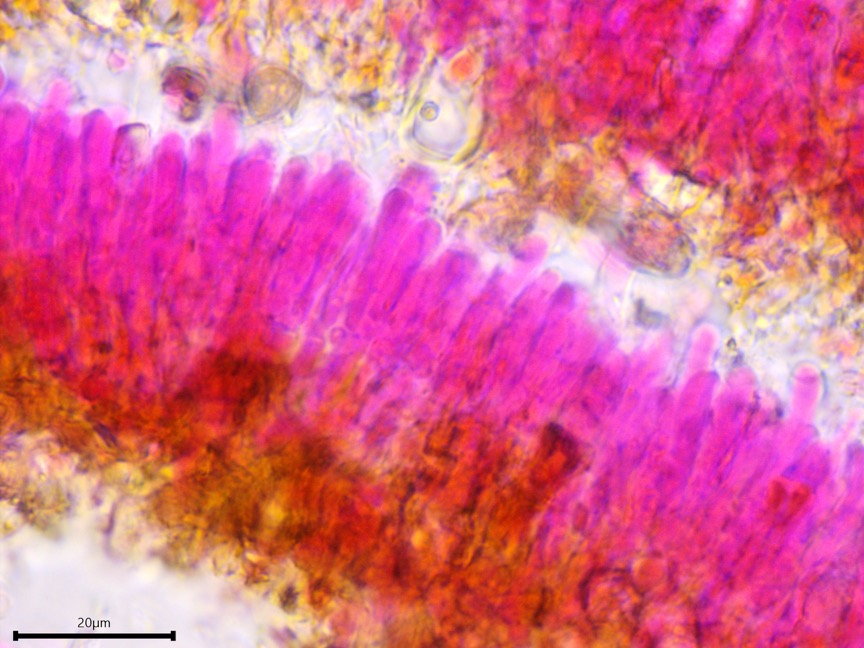Peniophora cinerea sidebar image 7 - clamp connection of Peniophora cinerea