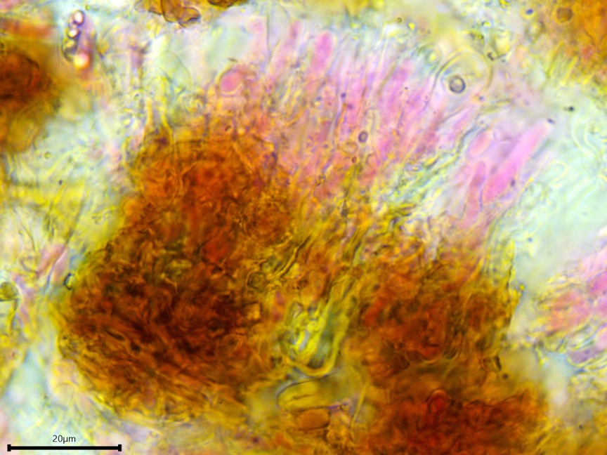 Peniophora cinerea sidebar image 8 - hyphae of Peniophora cinerea