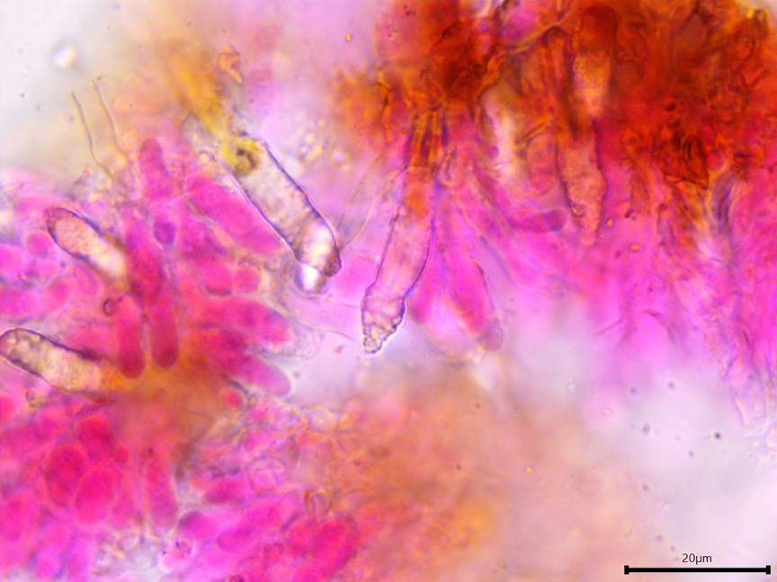 Peniophora cinerea sidebar image 10 - lamprocystidia of Peniophora cinerea