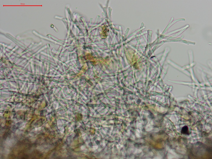 Punctularia strigosozonata sidebar image 6 - abhymenial hyphae of Punctularia strigosozonata