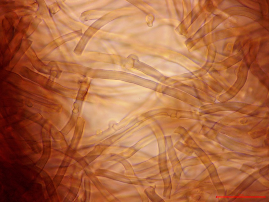 Punctularia strigosozonata sidebar image 7 - subhymenial hyphae of Punctularia strigosozonata