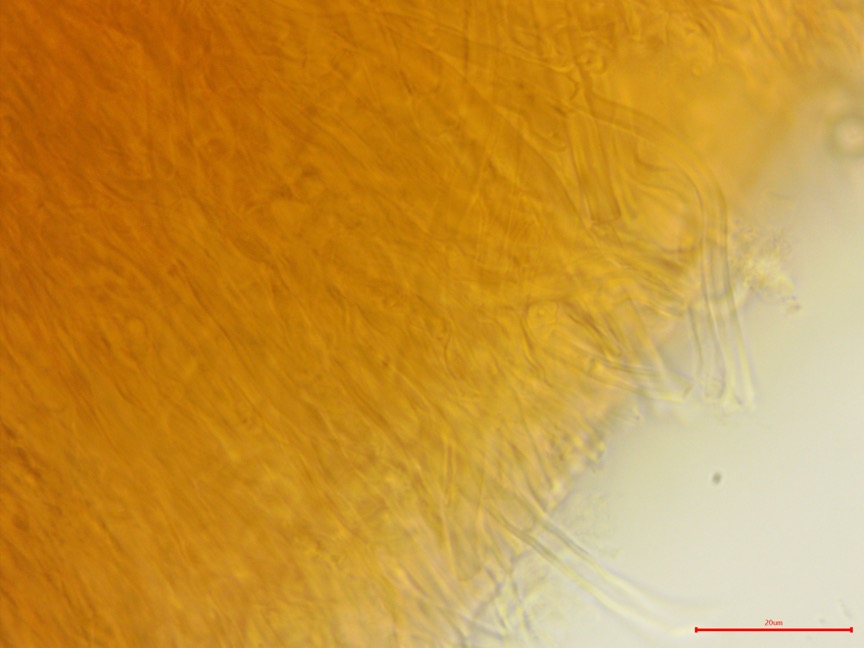 Punctularia strigosozonata sidebar image 8 - tramal hyphae of Punctularia strigosozonata