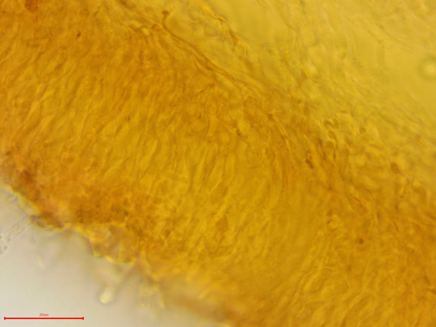 Punctularia strigosozonata sidebar image 9 - hyphae of Punctularia strigosozonata