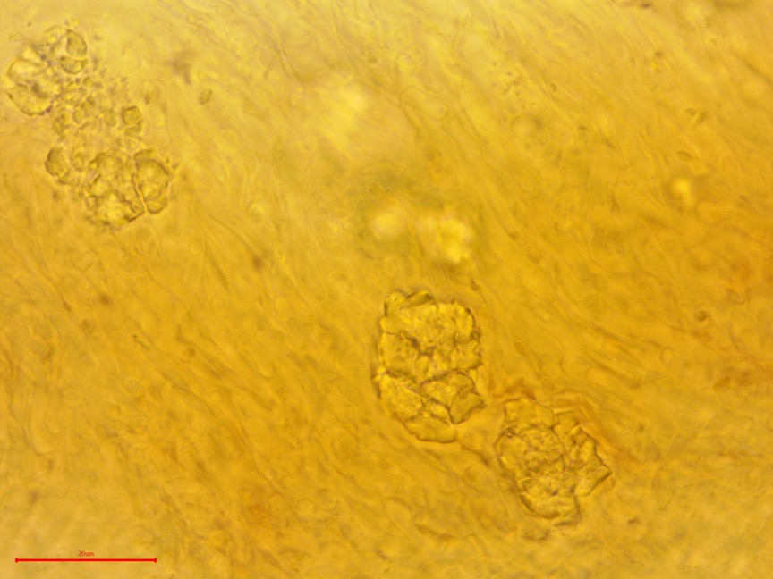Punctularia strigosozonata sidebar image 13 - hyphae of Punctularia strigosozonata