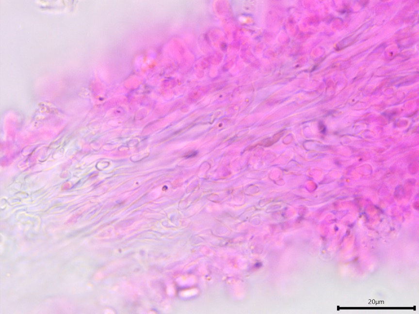 Sarcoporia polyspora sidebar image 6 - generative hyphae of Sarcoporia polyspora