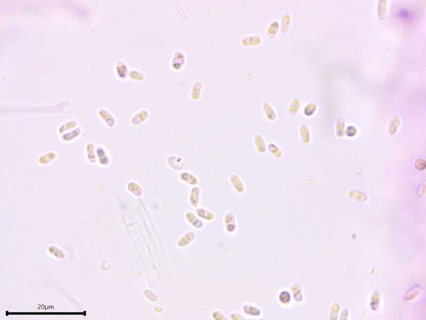 Sarcoporia polyspora sidebar image 7 - basidiospores of Sarcoporia polyspora
