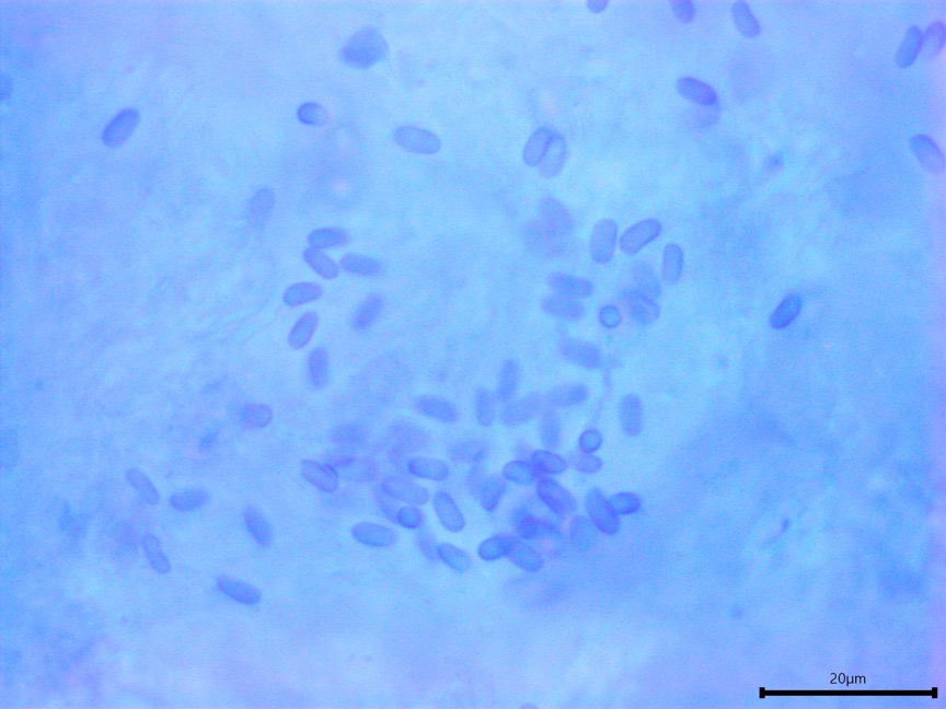 Sarcoporia polyspora sidebar image 10