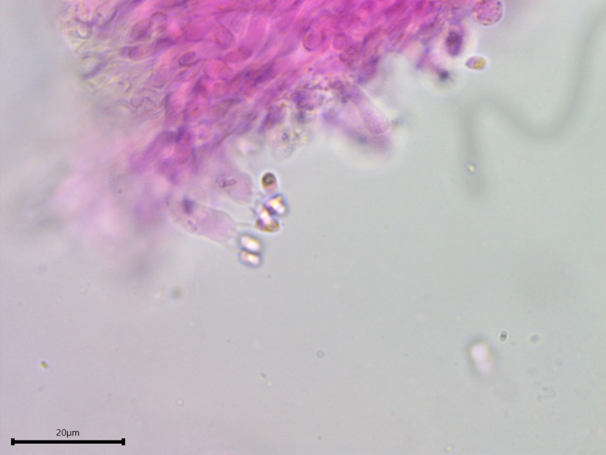 Sarcoporia polyspora sidebar image 11