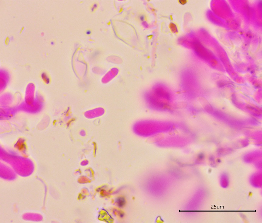 Sistotremastrum guttuliferum sidebar image 5 - basidiospores of Sistotremastrum guttuliferum