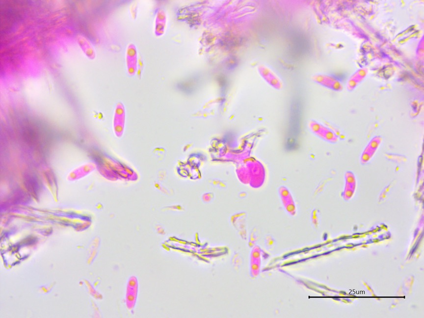 Subulicystidium brachysporum sidebar image 3 - basidiospores of Subulicystidium brachysporum