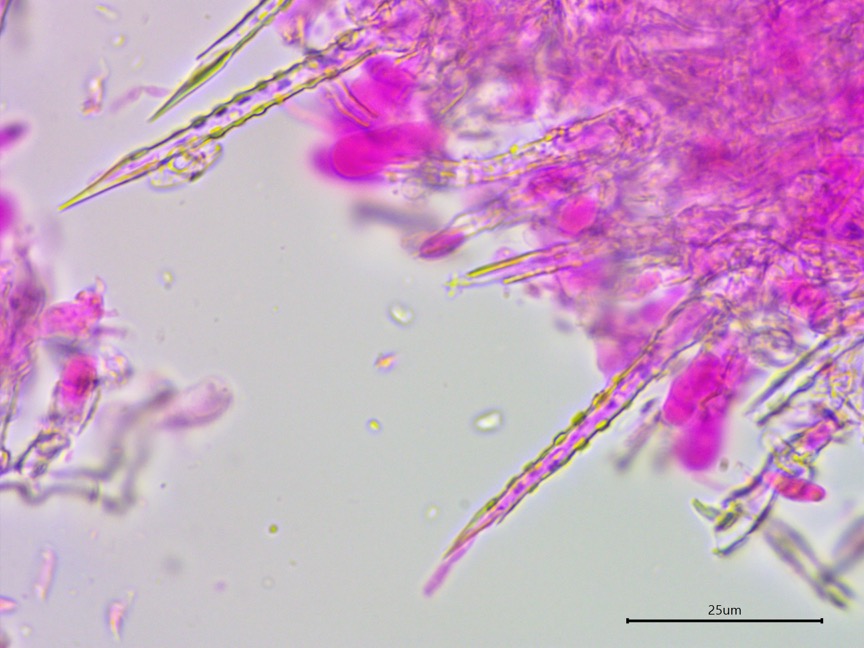 Subulicystidium brachysporum sidebar image 4 - subulate cystidia of Subulicystidium brachysporum