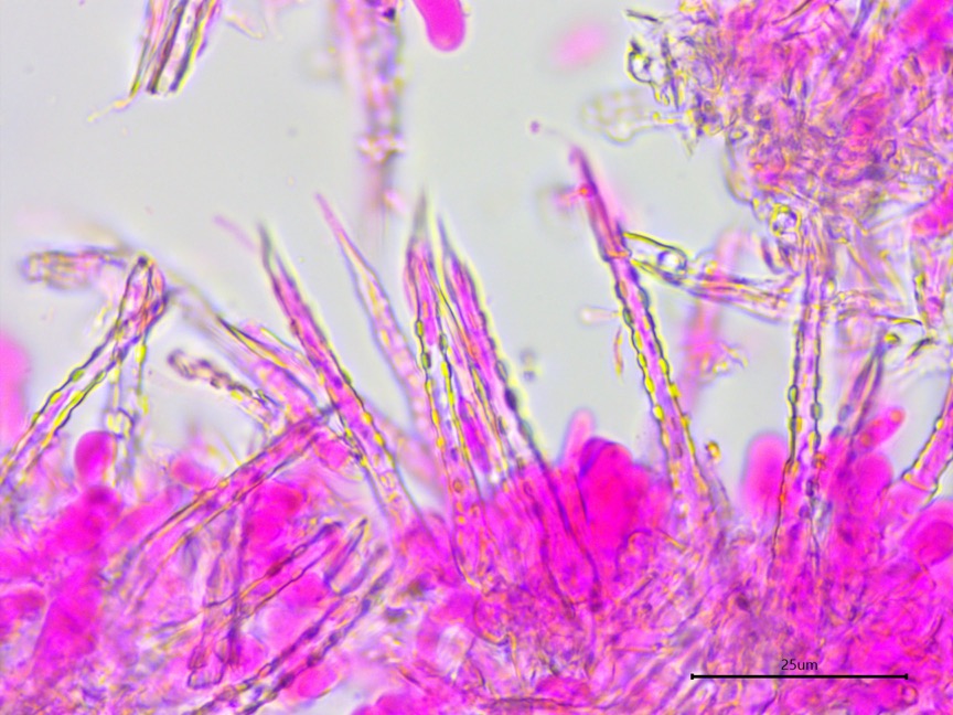 Subulicystidium brachysporum sidebar image 6 - subulate cystidia of Subulicystidium brachysporum