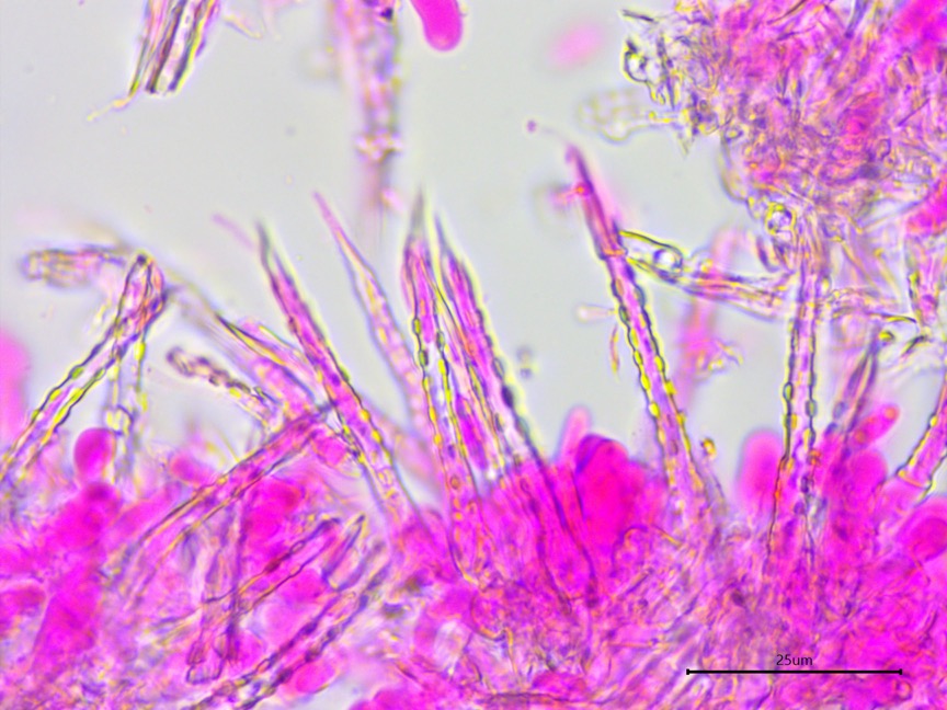 Subulicystidium brachysporum sidebar image 6 - subulate cystidia of Subulicystidium brachysporum