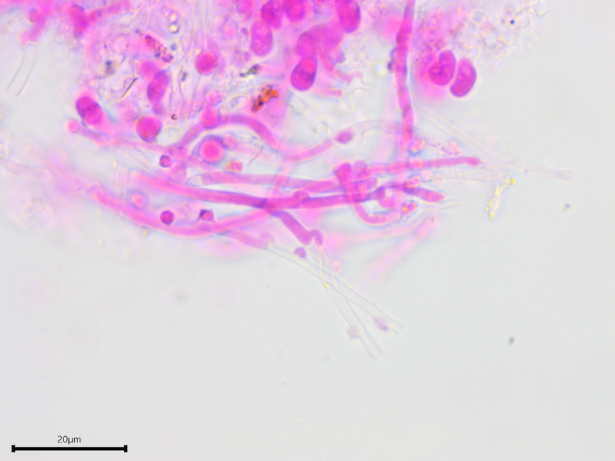 Trechispora stellulata sidebar image 7