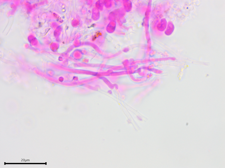 Trechispora stellulata sidebar image 7