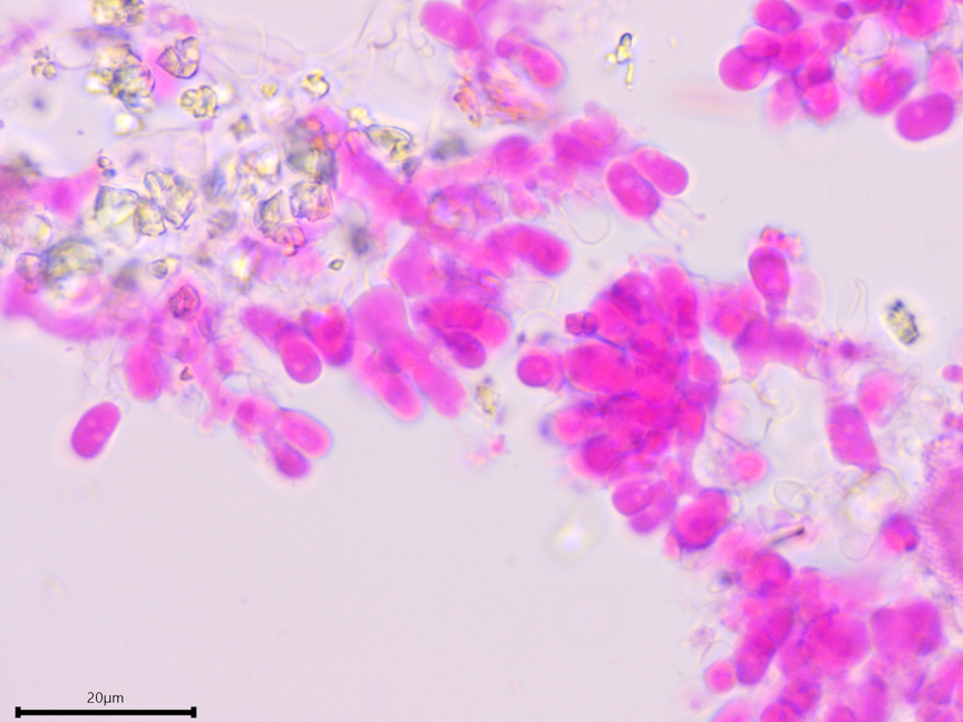 Trechispora stellulata sidebar image 4