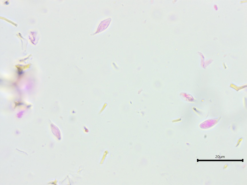 Vararia investiens sidebar image 4 - basidiospores of Vararia investiens