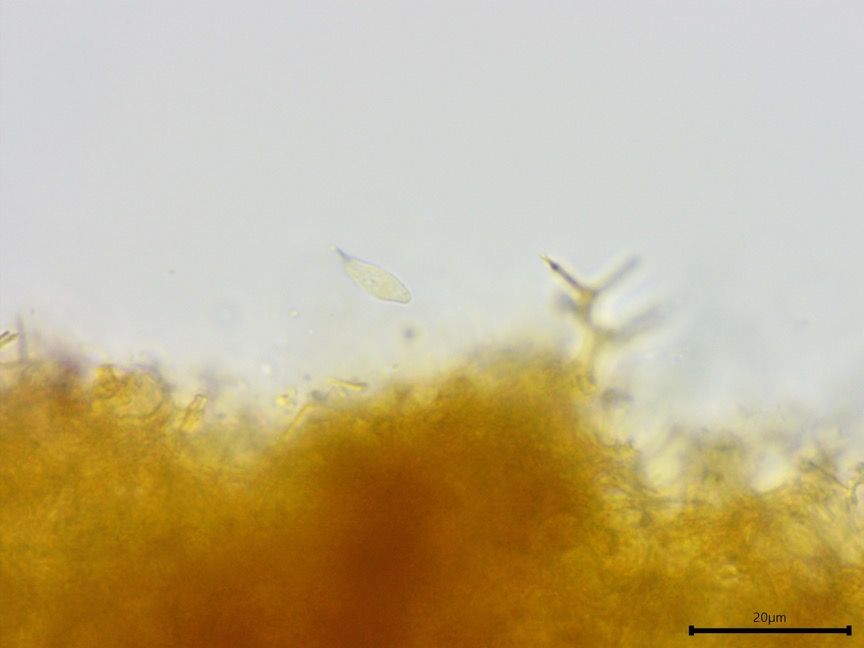 Vararia investiens sidebar image 5 - amyloid basidiospore tip of Vararia investiens