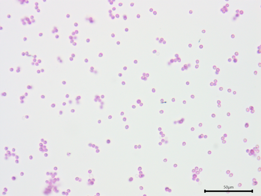 Xenasmatella sp. 'sublividus' sidebar image 8